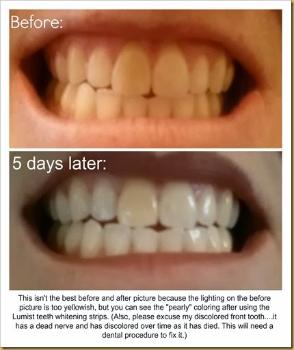 Lumist before and after