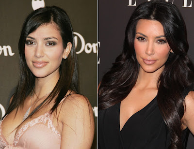 Kim Kardashian Before Plastic Surgery
