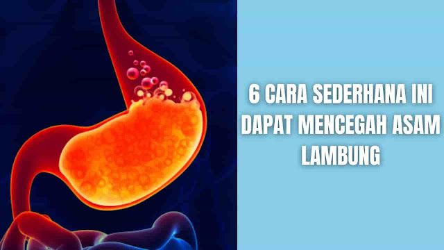 6 Cara Sederhana Ini Dapat Mencegah Asam Lambung Apa Itu Asam Lambung ? Asam lambung adalah sebuah kondisi munculnya suatu rasa terbakar di daerah dada akibat asam lambung naik ke kerongkongan.    Penyebab Penyebab umum dari asam lambung adalah kelainan pada lambung yang disebut hernia hiatus. Hal ini terjadi ketika pada bagian atas perut dan LES bergerak di atas diafragma, otot yang memisahkan perut dari dada. Biasanya, diafragma membantu menjaga asam di perut kita. Akan tetapi jika Anda memiliki hernia hiatus, asam dapat naik ke kerongkongan dan menyebabkan gejala Asam Lambung. Faktor risiko umum lainnya:  Makan dalam porsi besar atau langsung berbaring setelah makan Kelebihan berat badan atau obesitas Makan makanan berat dan berbaring telentang atau membungkuk di pinggang Ngemil menjelang tidur Makan makanan tertentu, seperti jeruk, tomat, coklat, mint, bawang putih, bawang merah, atau makanan pedas atau berlemak Minum minuman tertentu, seperti alkohol, minuman berkarbonasi, kopi, atau teh Merokok Sedang hamil Memakan obat aspirin, ibuprofen, pelemas otot tertentu, atau obat tekanan darah    Gejala Umumnya pada kondisi asam lambung memiliki gejala:  Mulas, rasa ketidaknyamanan yang membakar yang dapat berpindah dari perut ke perut atau dada, atau bahkan naik ke tenggorokan Regurgitasi, asam atau pahit yang masuk ke tenggorokan atau mulut Kembung Kotoran berdarah atau hitam atau muntah berdarah Bersendawa Disfagia, sesani makanan tersangkut di tenggorokan Cegukan yang tak kunjung reda Mual Penurunan berat badan tanpa alasan yang diketahui Mengi, batuk kering, suara serak, atau sakit tenggorokan kronis    Cara Mencegah Asam Lambung Upaya di dalam mencegah asam lambung sangat diperlukan, karena asam lambung bisa menyakitkan dan tidak nyaman. Akan tetapi ada perubahan yang dapat dilakukan pada pola makan dan gaya hidup untuk membantu mencegah episode berikutnya.  Hindari makanan pemicu Menghindari makan dua hingga tiga jam sebelum tidur Makan makanan seimbang yang kaya buah, protein, dan sayuran Pertahankan berat badan yang sehat Duduk atau berdiri setelah makan, dan hindari berbaring Tidur di pada posisi kasur ditinggi (seperti tanjankan). Tinggikan kepala Anda 6 hingga 8 inci lebih tinggi dari kaki Anda Berhenti merokok  Beberapa jenis makanan pemicu asam lambung:  Makanan berlemak atau gorengan Alkohol Kopi Minuman berkarbonasi, seperti soda Cokelat Bawang putih Bawang Buah sitrus Permen Tanaman permen Saos tomat