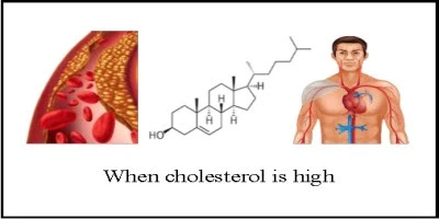 When cholesterol is high