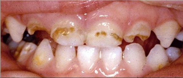 Klinik Gigi Anak dan Behel Gigi Kidz Dental Orthodontic 