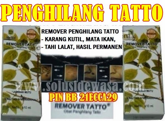 http://www.solusidewasa.com/2014/03/remover-obat-pengilang-tatto-permanet.html