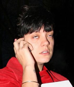 Lily Allen at worst