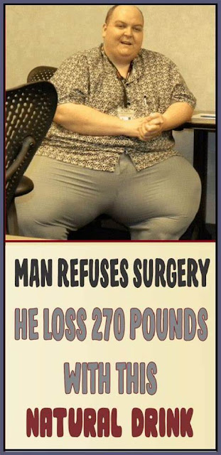 Man refuses surgery, He Loss 270 Pounds With This Natural Drink