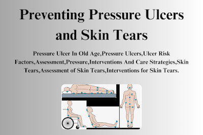 Preventing Pressure Ulcers and Skin Tears
