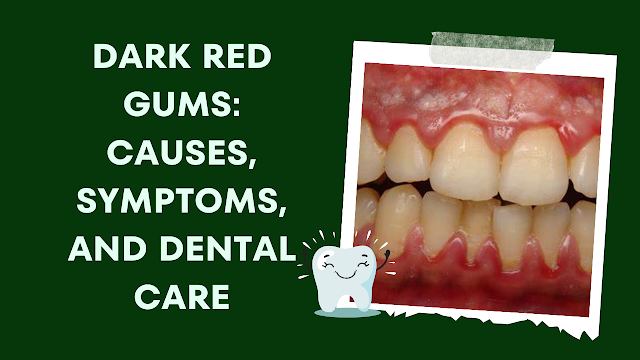 Dark Red Gums: Causes, Symptoms, and Dental Care
