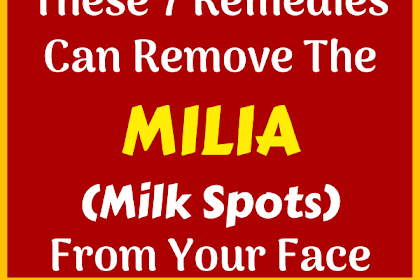 These 7 Remedies Can Remove The Milia (Milk Spots) From Your Face