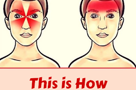 This is How Headaches Reveal What's Wrong With Your Health (And How to Cure it Naturally)