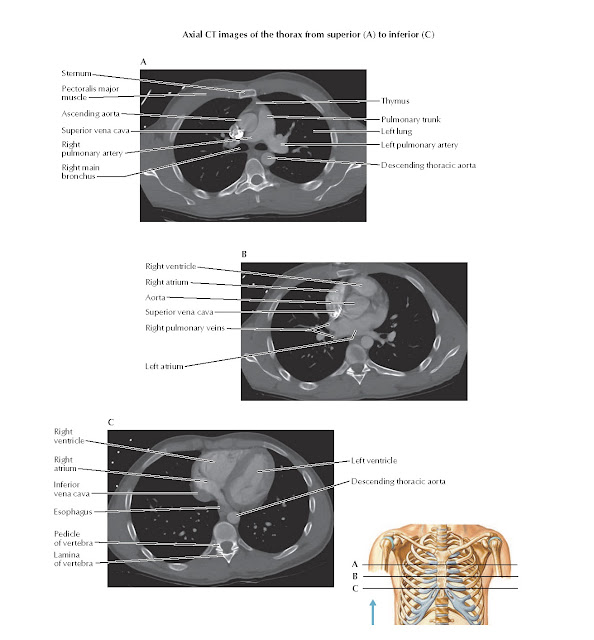 Chest Scans: Axial CT Images Anatomy