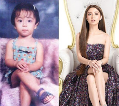 Donnalyn Bartolome picture in her childhood and now
