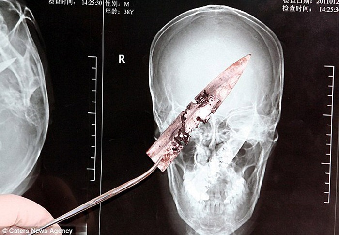 knife-in-head1