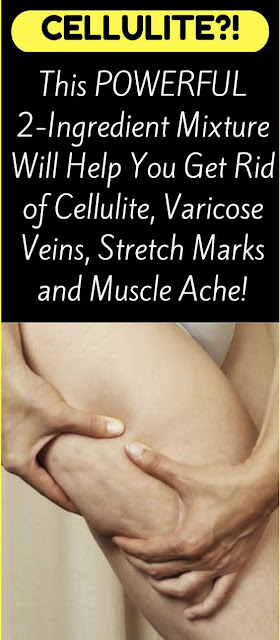 APPLE CIDER VINEGAR HELPS CELLULITE DISAPPEAR MAGICALLY!