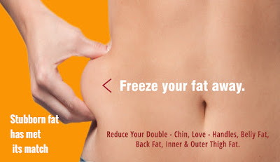 http://tlcclinique.com/cryolipolysis