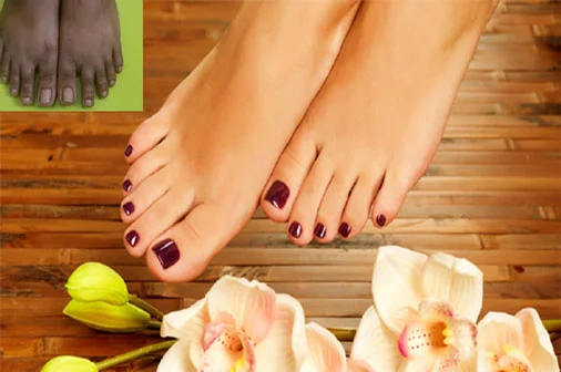 Feet Whitening Pedicure At Home