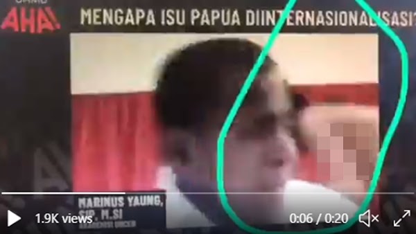 Viral Muncul Perempuan Tak Berbaju Saat Live Webinar, Dosen Uncen: Ini Anak Perempuan Saya