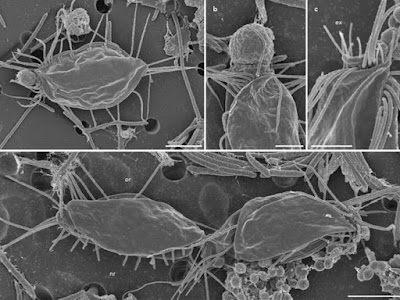Ilmuwan Menemukan Mikroba Baru Yang Aneh, Bentuknya Seram