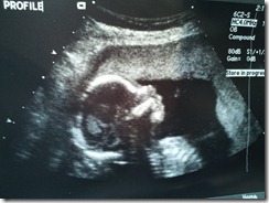 2012-06-08 15.06.14