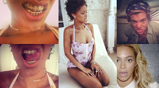 Rihanna, Beyonce and Harry Styles-Crowded Crowded Unique Exhibition Braces