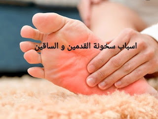 اسباب سخونة القدمين و الساقين