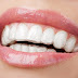 Thông tin về niềng răng trong suốt