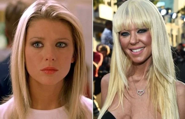 Celebrity Plastic Surgery Mishaps That Left Fans Stunned