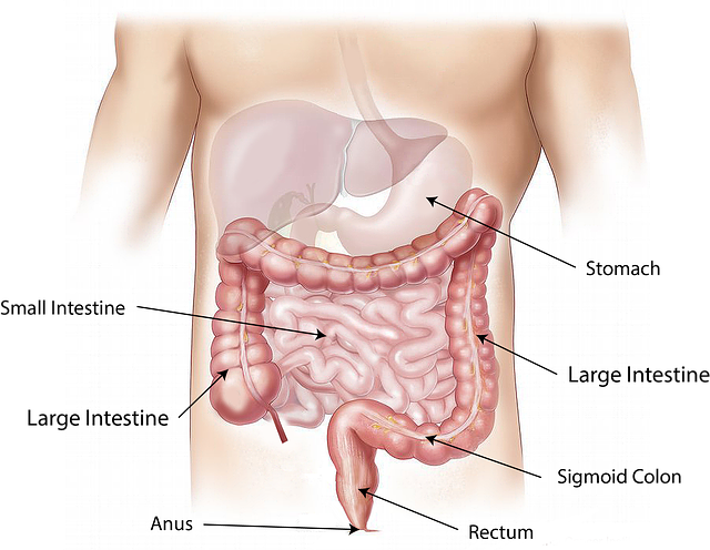 Ulcerative Colitis