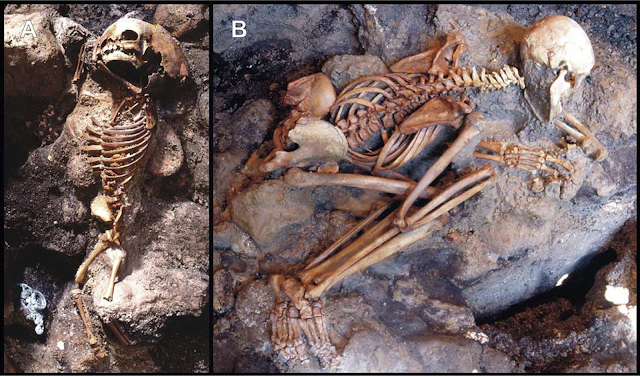 A hypothesis of sudden body fluid vaporization in the 79 AD victims of Vesuvius