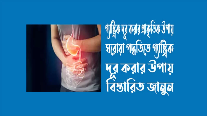 গ্যাস্ট্রিক দূর করার প্রাকৃতিক উপায়