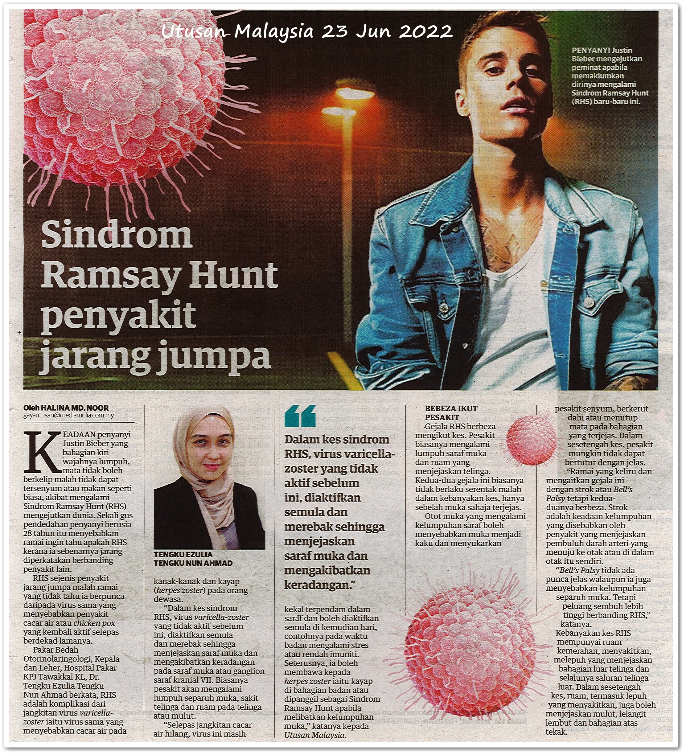 Sindrom Ramsay Hunt penyakit jarang jumpa