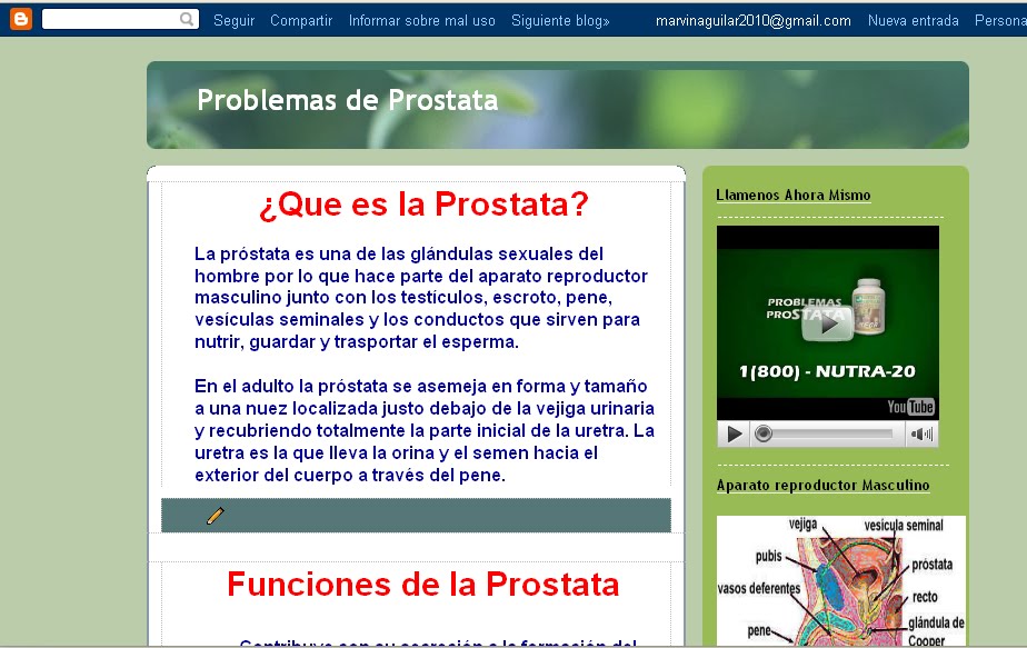 https://blogger.googleusercontent.com/img/b/R29vZ2xl/AVvXsEiePwQBkYS2GD8Kqv_oIWpx627rNIT5MSonEa-6cVfMRduDhbLLIG_2dNNAVPcMciQt_aqmolb24OCxKFJip1wR09j1qQjgyZFT71m4Ugep9f-d0dKd7QYt95O3y614OoQ3rLjkZqWxJ7Q/s1600/prostatacocaone.bmp