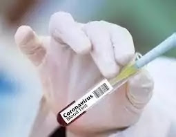Corona Vaccine News ll Success in The First Corona Vaccine ll MRNA1273