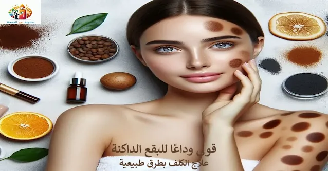 الكلف