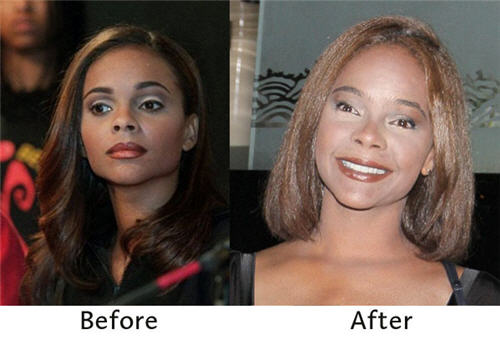 anna faris plastic surgery before after. Lark Voorhies efore and after