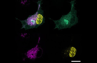 Localization of FSP1 in green, cell nucleus in yellow, endoplasmic reticulum in magenta. © Rudolf Virchow Centre for Experimental Biomedicine University Würzburg