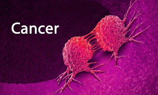 5 Cancer Symptoms