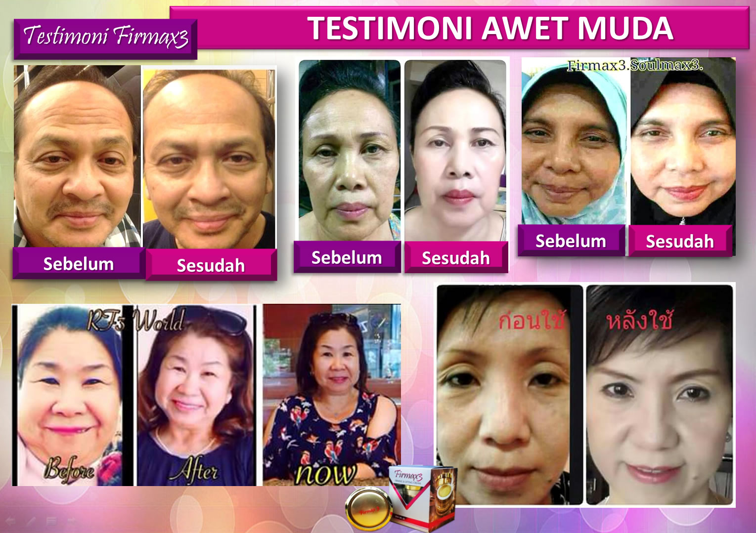 Testimoni Firmax3 Cream Indonesia