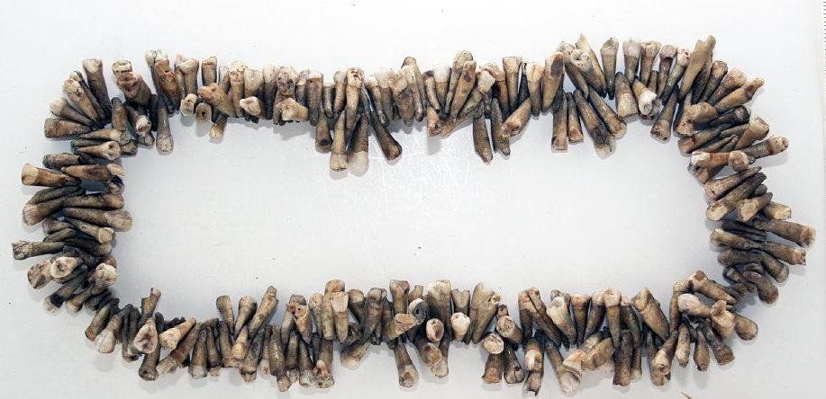 A necklace of extracted teeth that Painless Parker wore when he went to work.