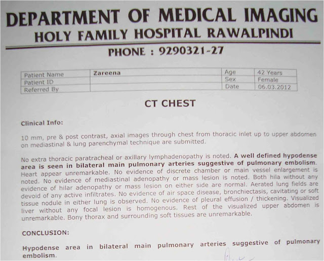 CT-scan-report-of-Pulmonary-embolism