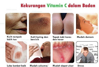 vita c shaklee; vitamin c shaklee; vitamin c semulajadi; vitamin c paling bagus; jenama vitamin c yang paling bagus