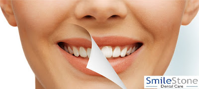 Best Orthodontist in Nagpur