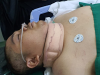 Seorang Mahasiswa Al-Azhar Kritis Setelah Demonstrasi Ricuh