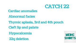 CATCH 22 mnemonics for DiGeorge