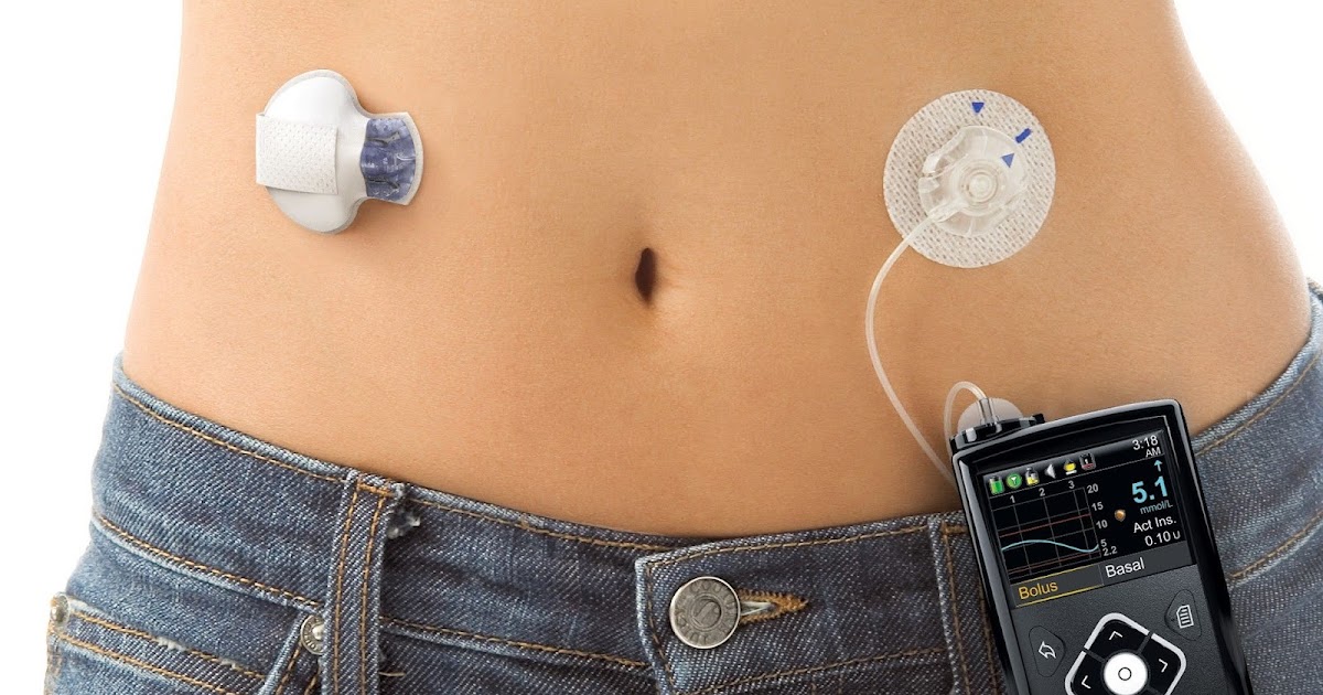 How do Artificial Pancreas Device System (APDS) Work?