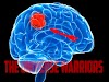 What is  Brain tumors ?