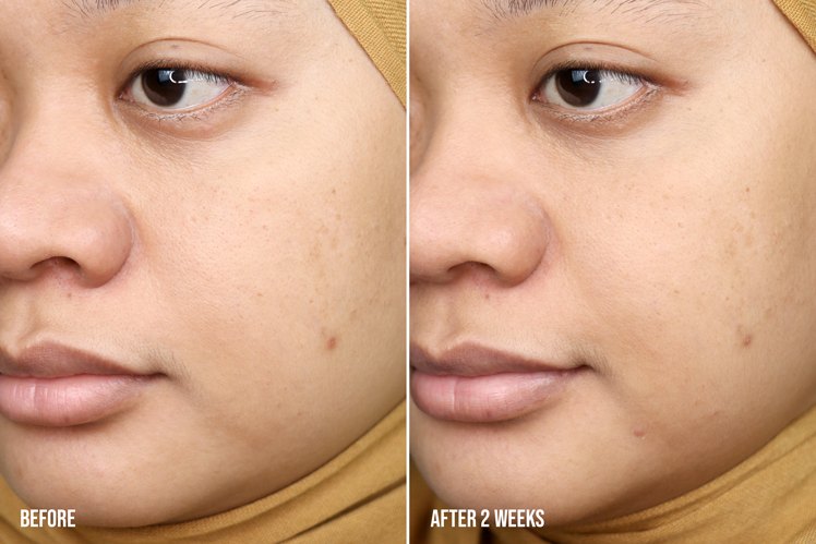 Before After Scarlett Retinol Serum