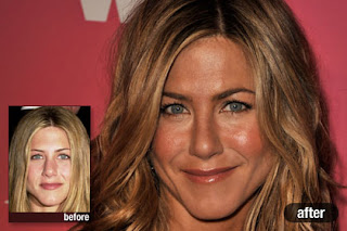 Jennifer Aniston Plastic Surgery