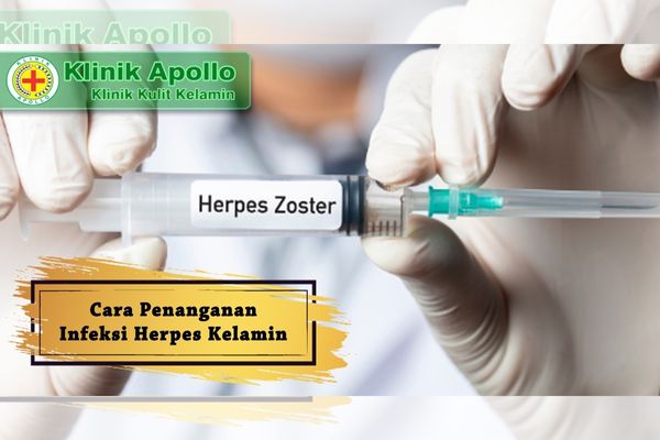 cara menangani infeksi herpes kelamin