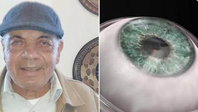 Blind man regains sight after receiving artificial cornea implant 