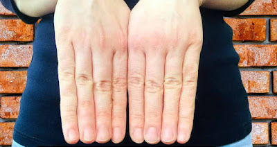 What would happen if all five fingers were of equal length?