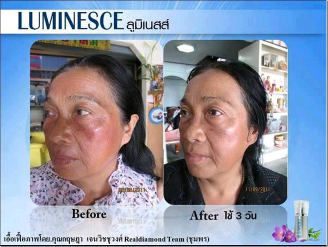 3_Great Serum results